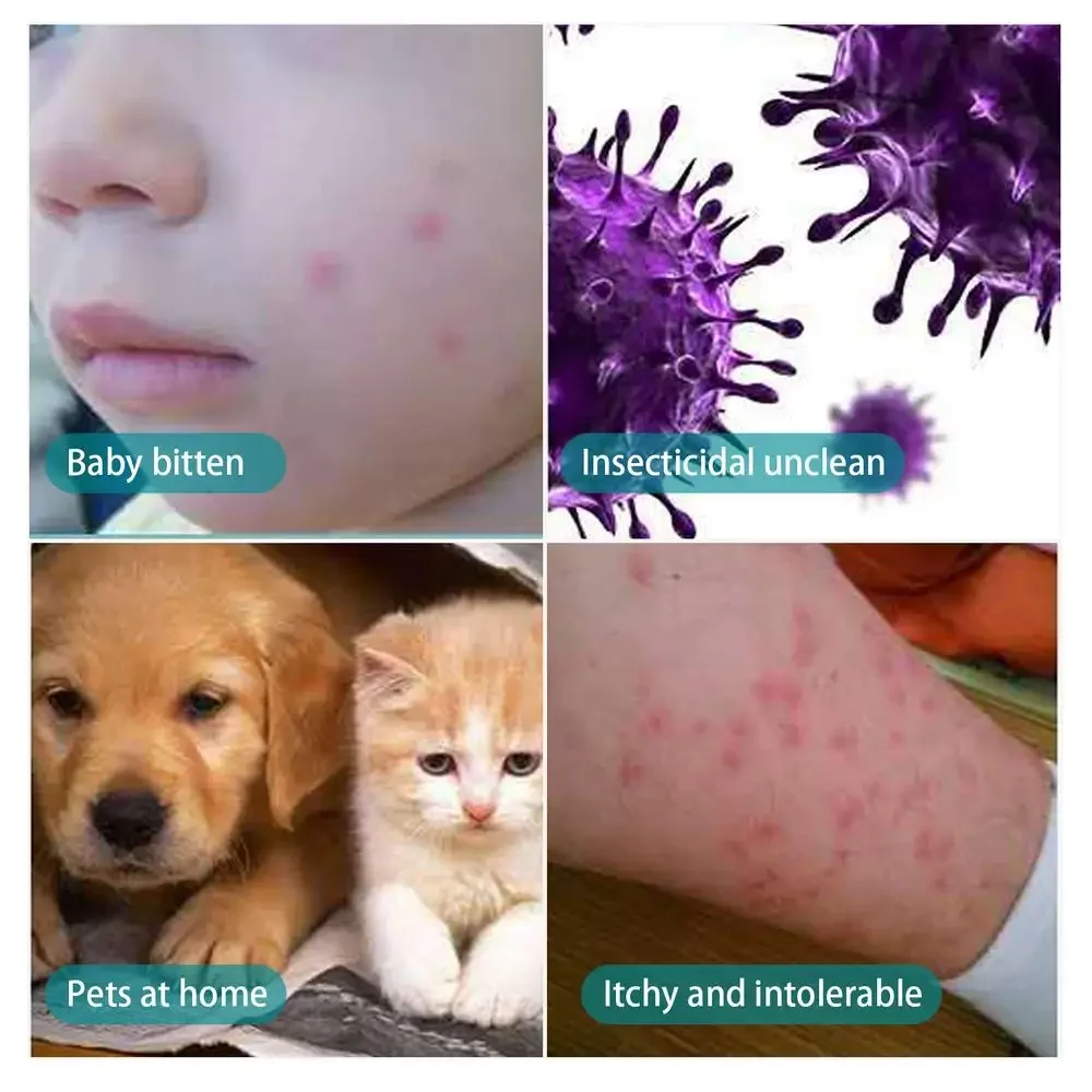 100ml Pet Expel Fleas Lice Treatments Spray Quick And Handy Fleas Ticks Expellent For Dogs Cats Pet Health Supplies - Image 10